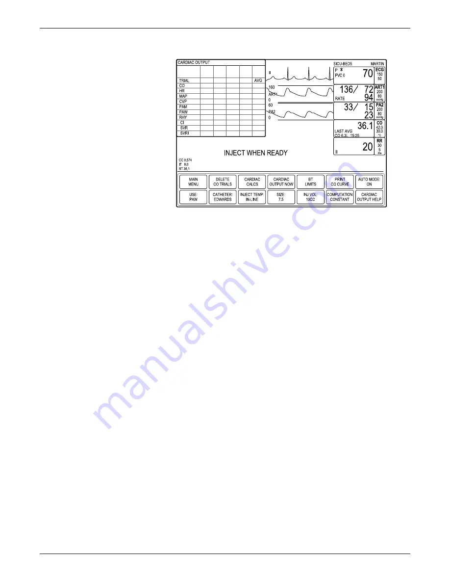 GE Dash 3000 Operator'S Manual Download Page 153