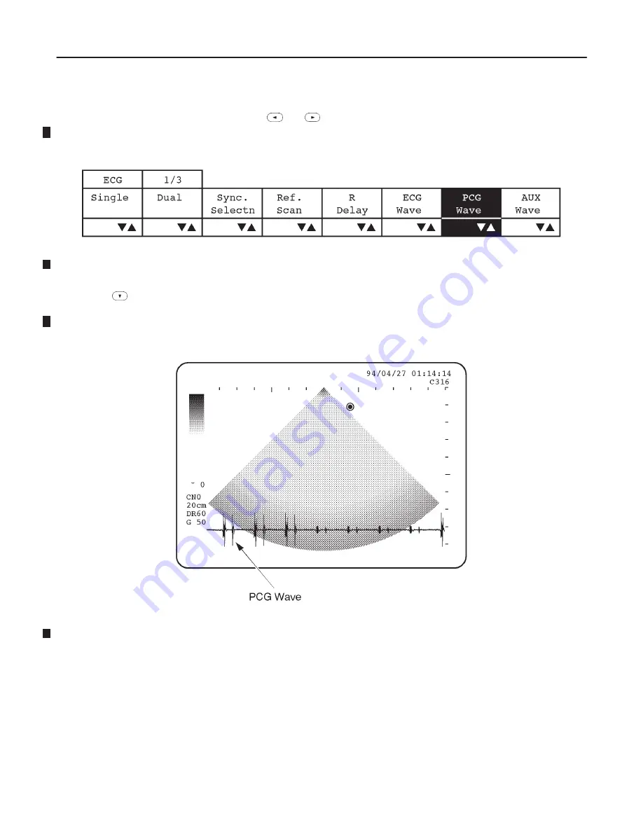 GE LOGIQ 400 Service Manual Download Page 501