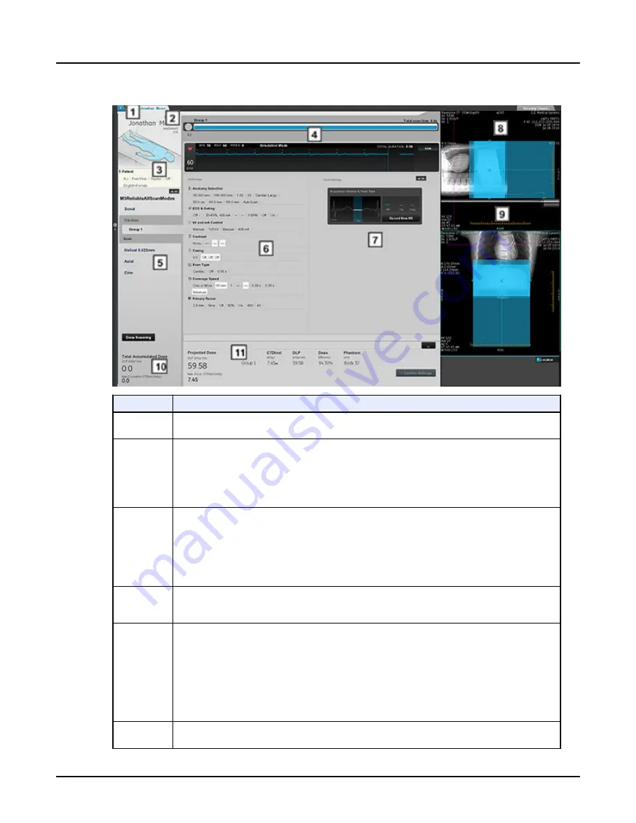 GE Revolution CT User Manual Download Page 103