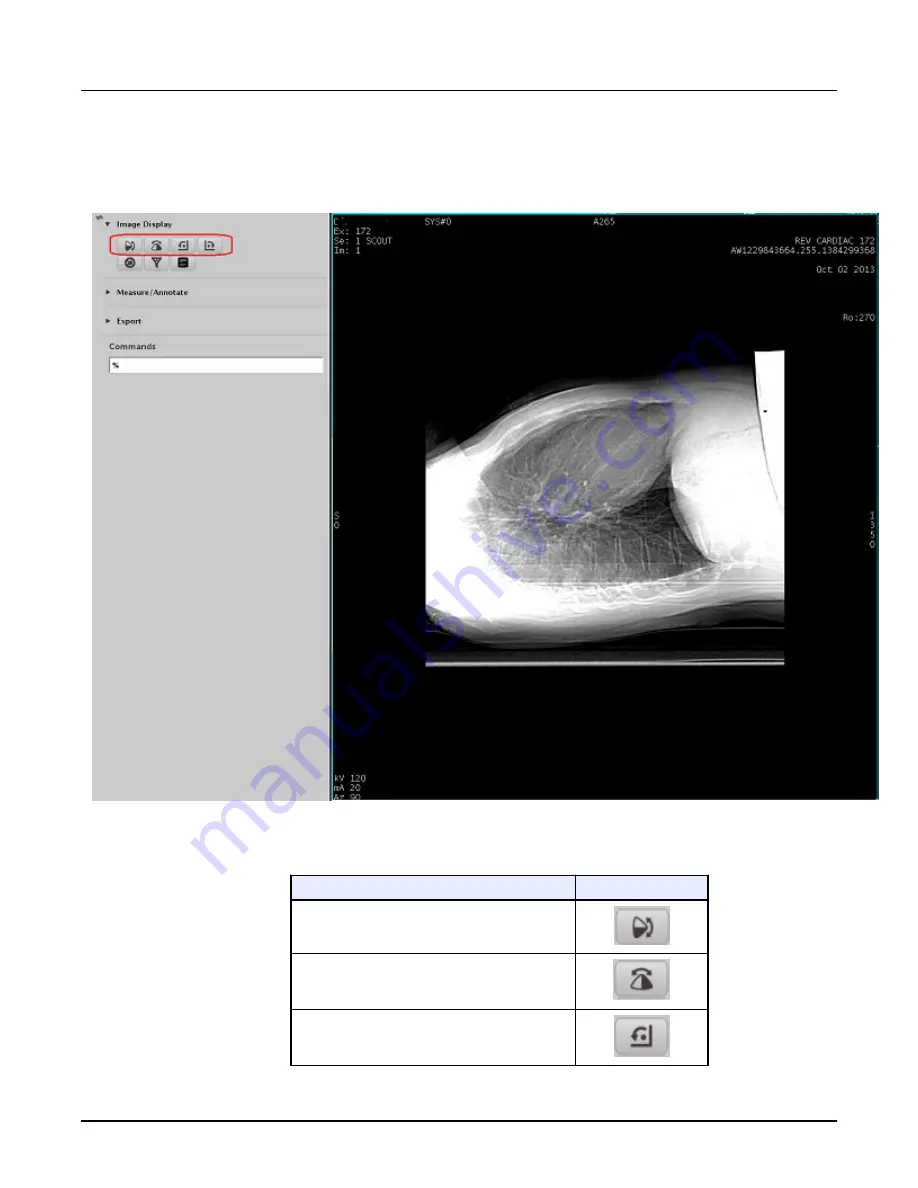 GE Revolution CT User Manual Download Page 390