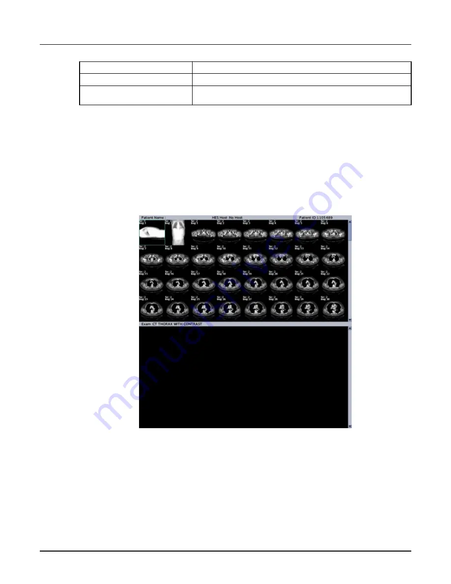 GE Revolution CT User Manual Download Page 438