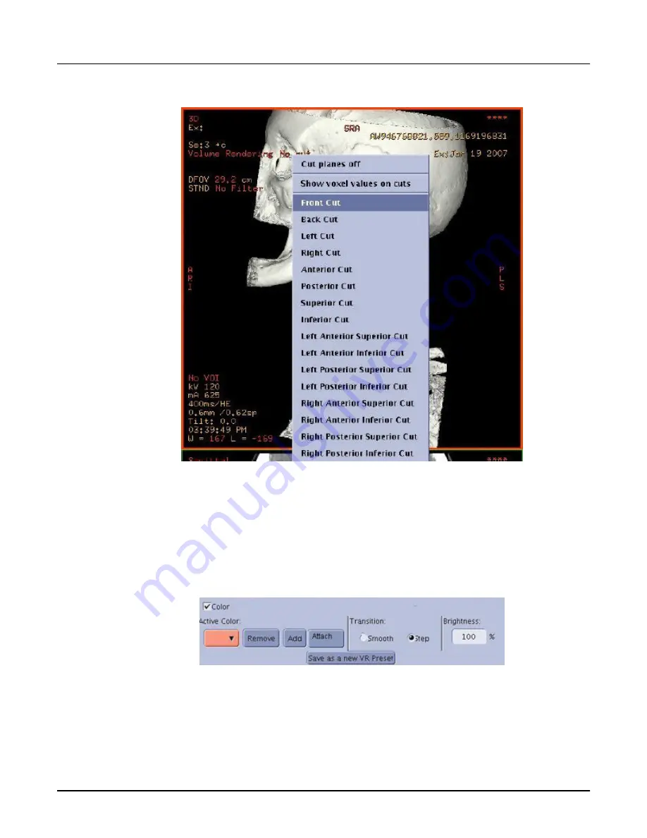 GE Revolution CT User Manual Download Page 477