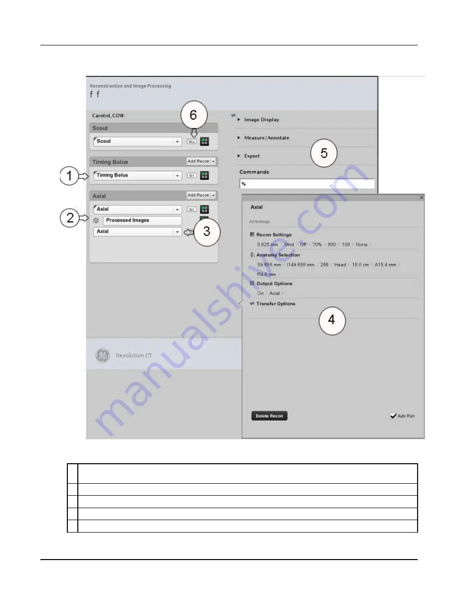 GE Revolution CT User Manual Download Page 568