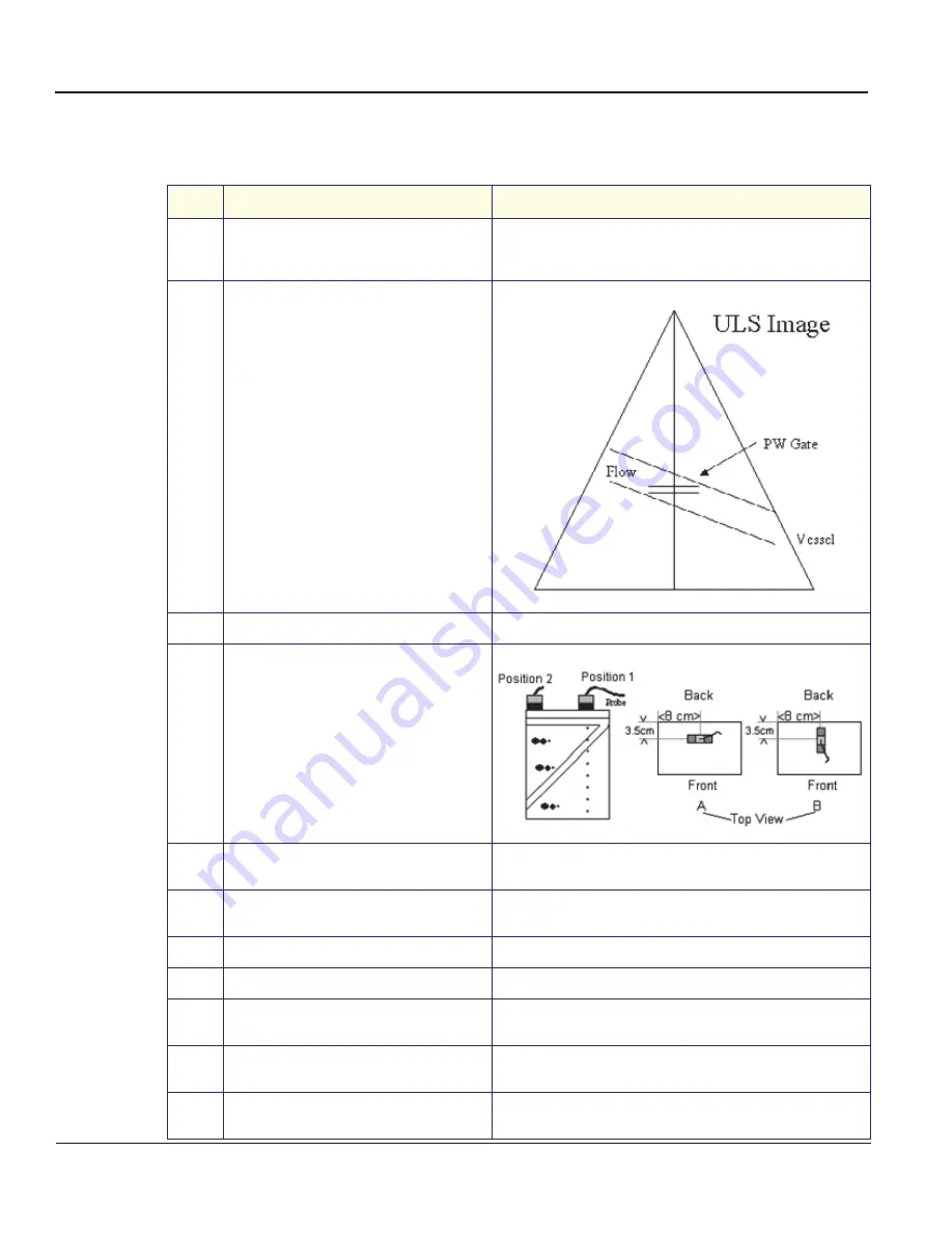 GE Vivid 3 Service Manual Download Page 164