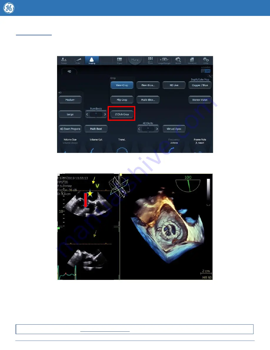 GE Vivid E95 Tips Download Page 15