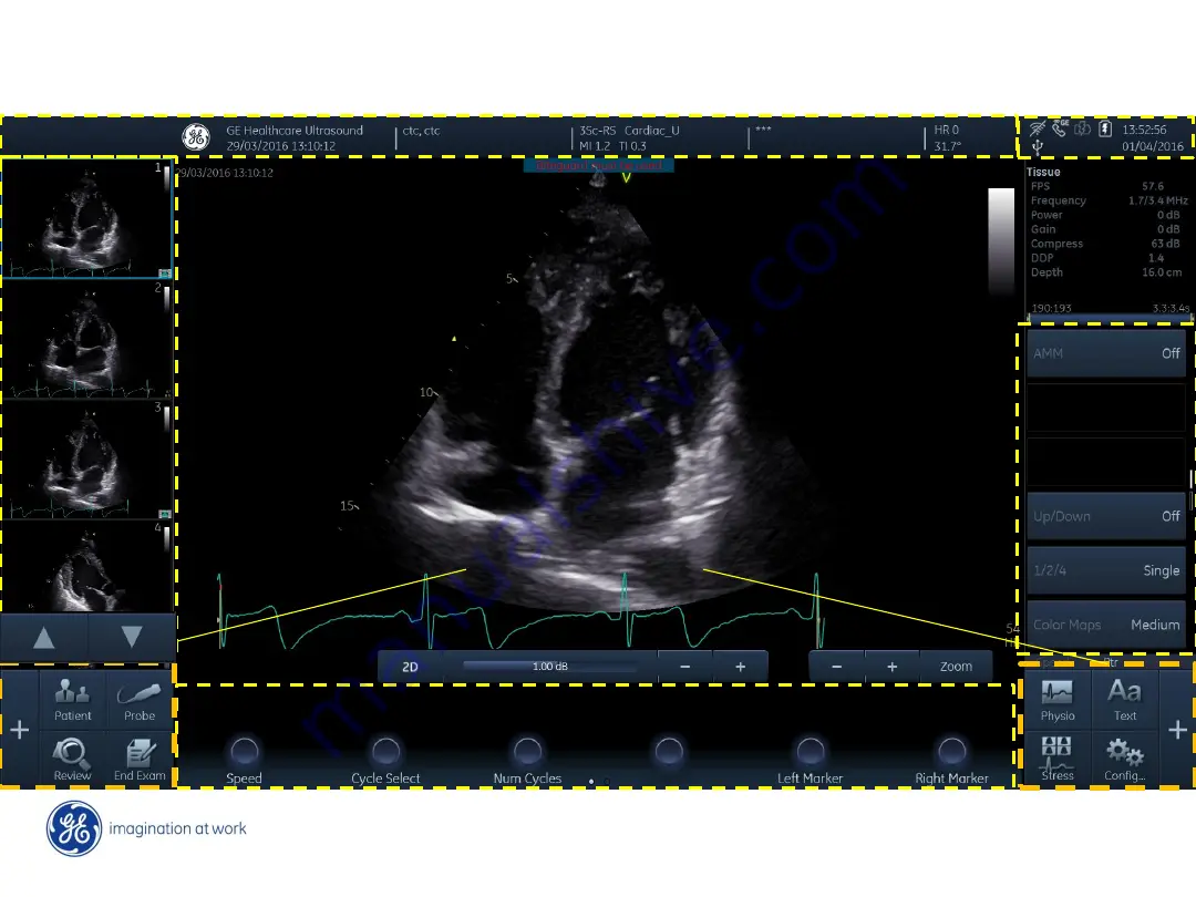 GE Vivid iq Quick Manual Of Gestures Download Page 2