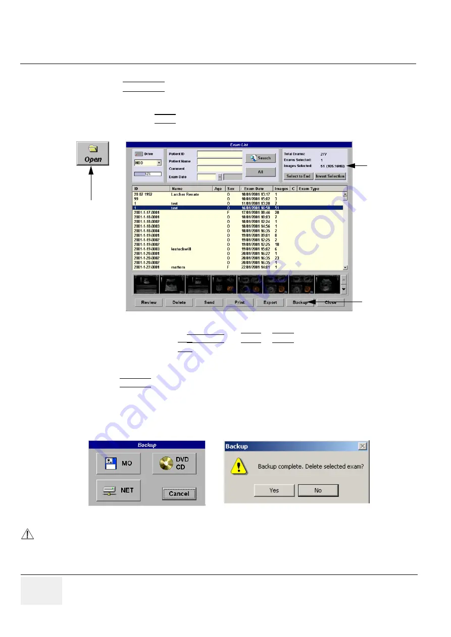 GE Voluson 730Pro Service Manual Download Page 140