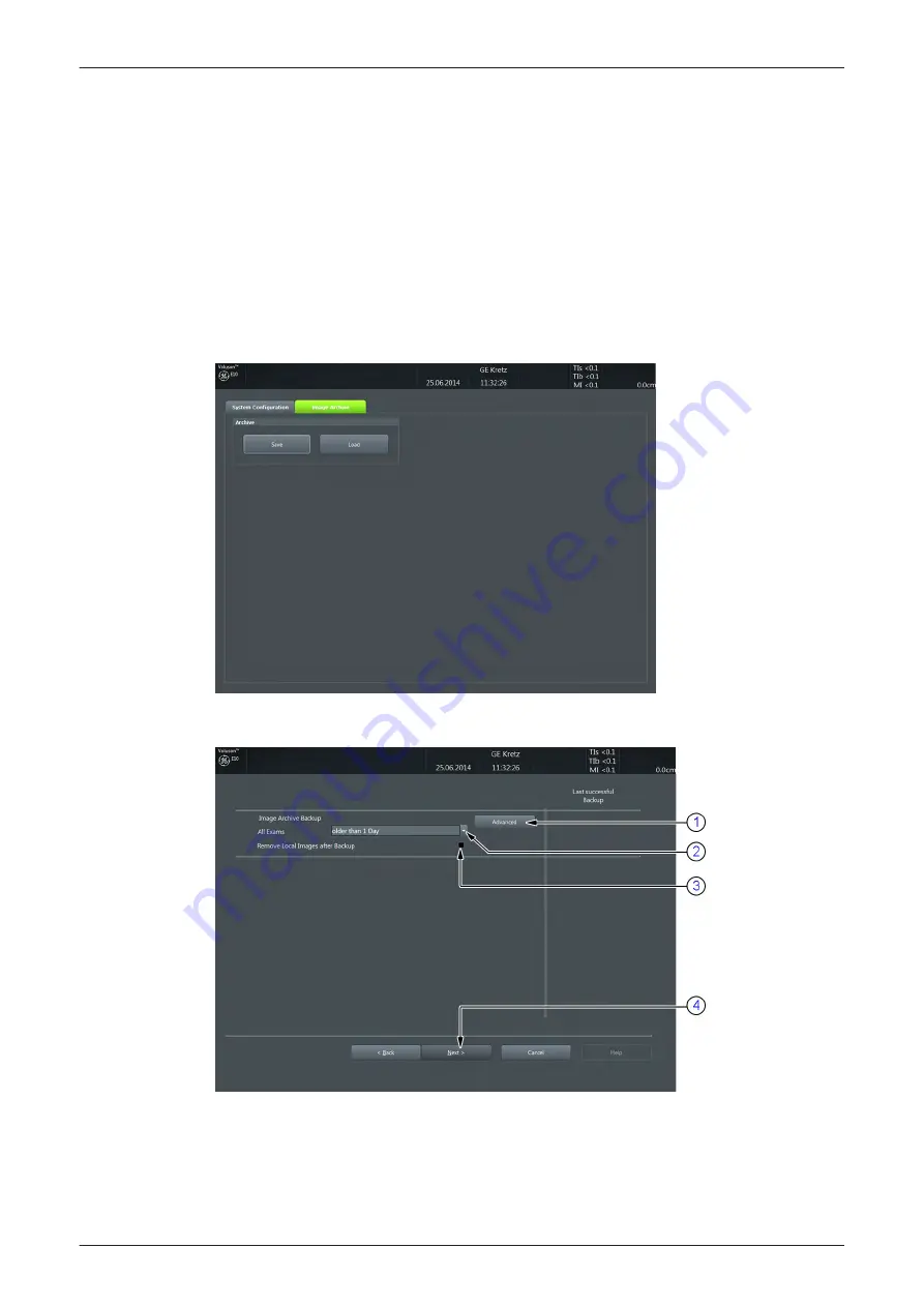 GE Voluson E Series Service Manual Download Page 140