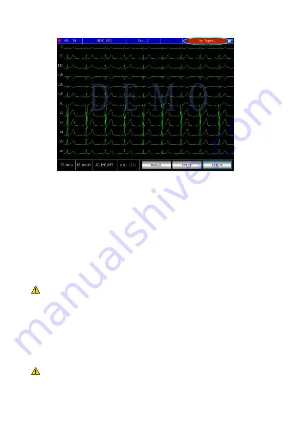 Gima 1200G ECG Скачать руководство пользователя страница 22