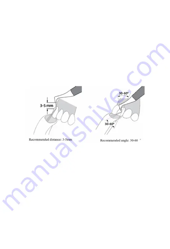 Guilin Woodpecker Medical Instrument AP-A Скачать руководство пользователя страница 8