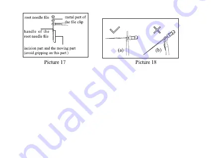 Guilin Woodpecker Medical Instrument Minipex Instruction Manual Download Page 18