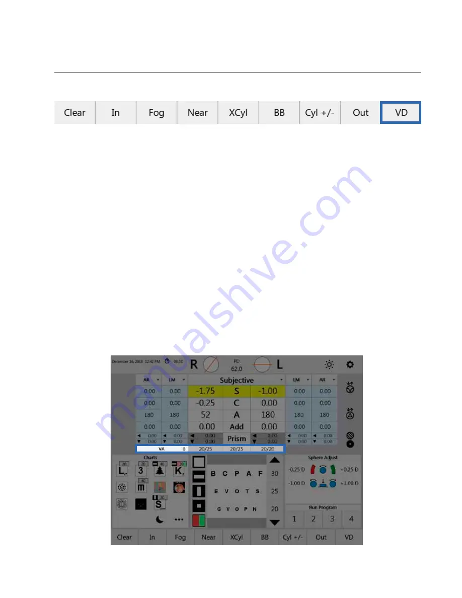 Haag-Streit VISUTRON 900 Touch User Manual Download Page 63