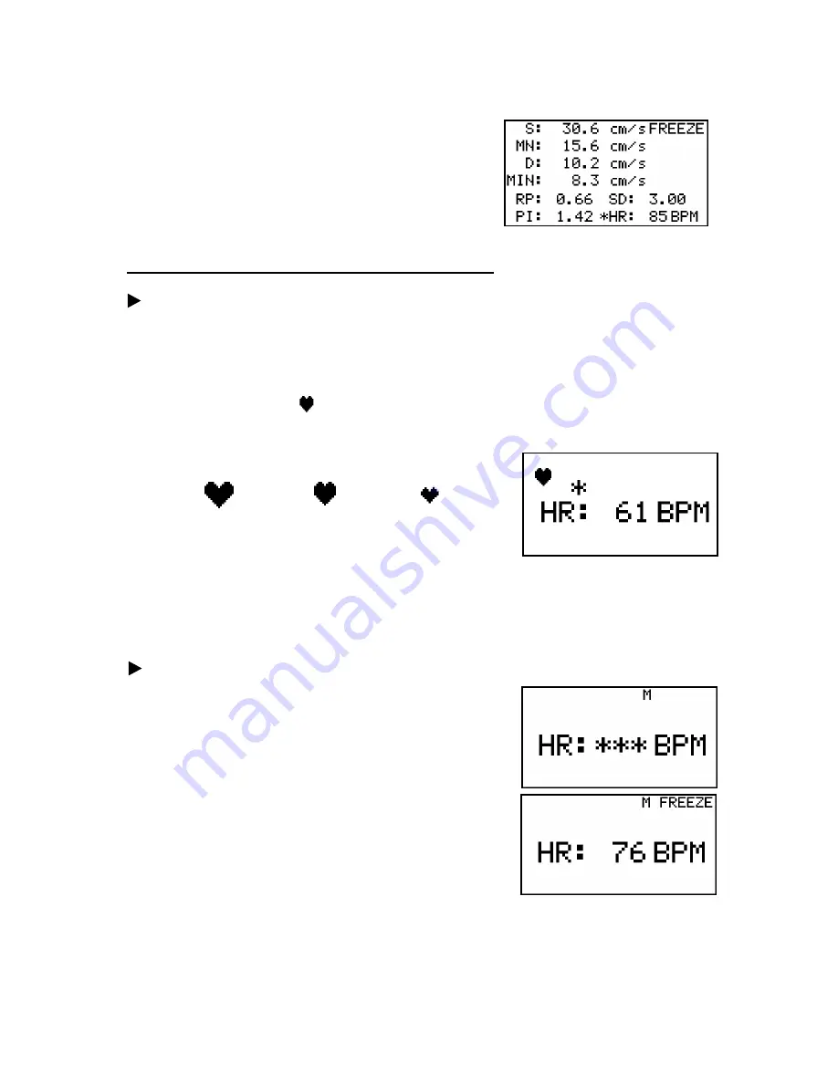 Hadeco Bidop ES-100V3 Operating Manual Download Page 39