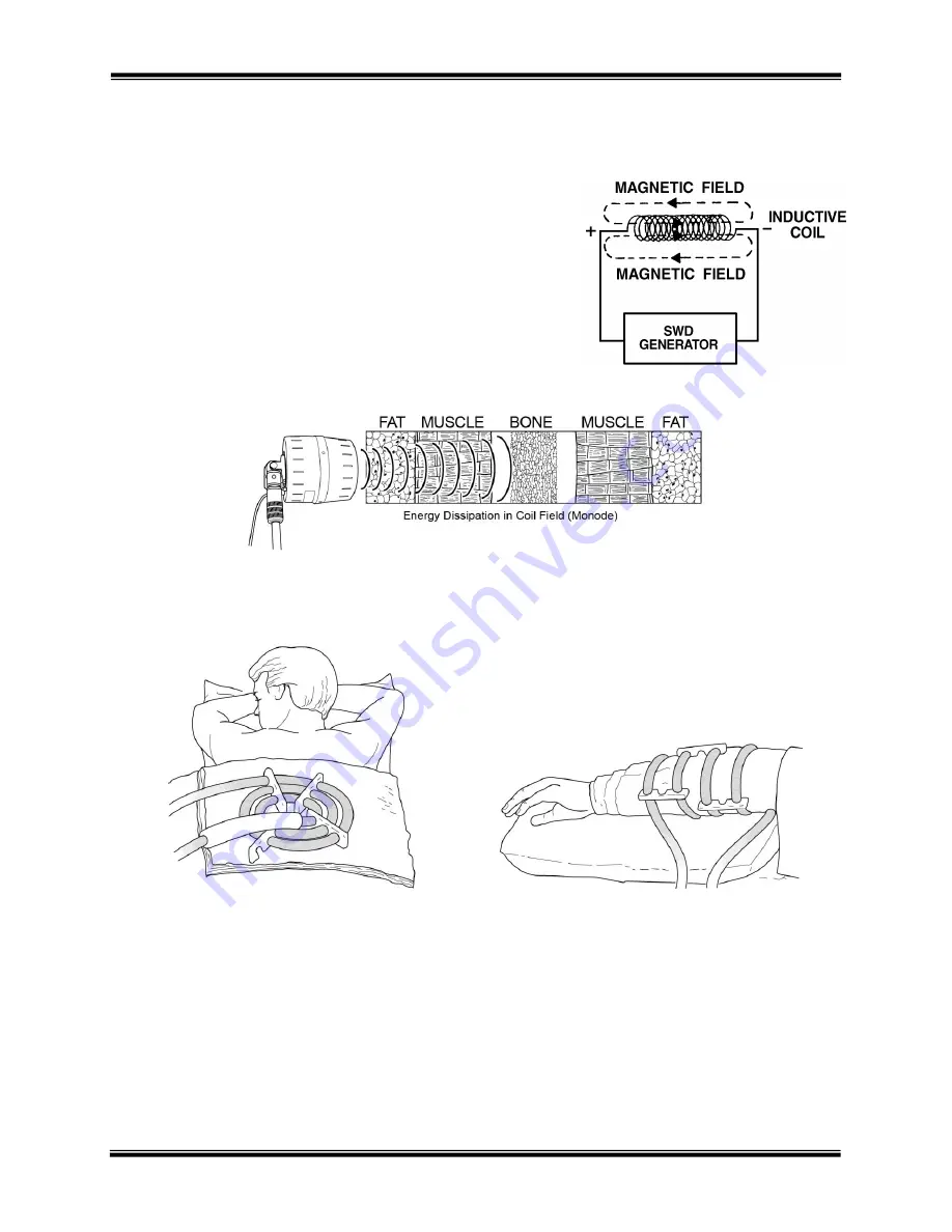 Hanger 1903029 User Manual Download Page 12