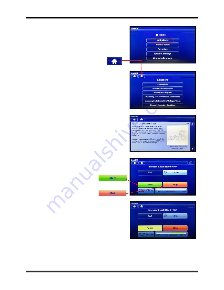 Hanger ACP OmniSWD User Manual Download Page 20