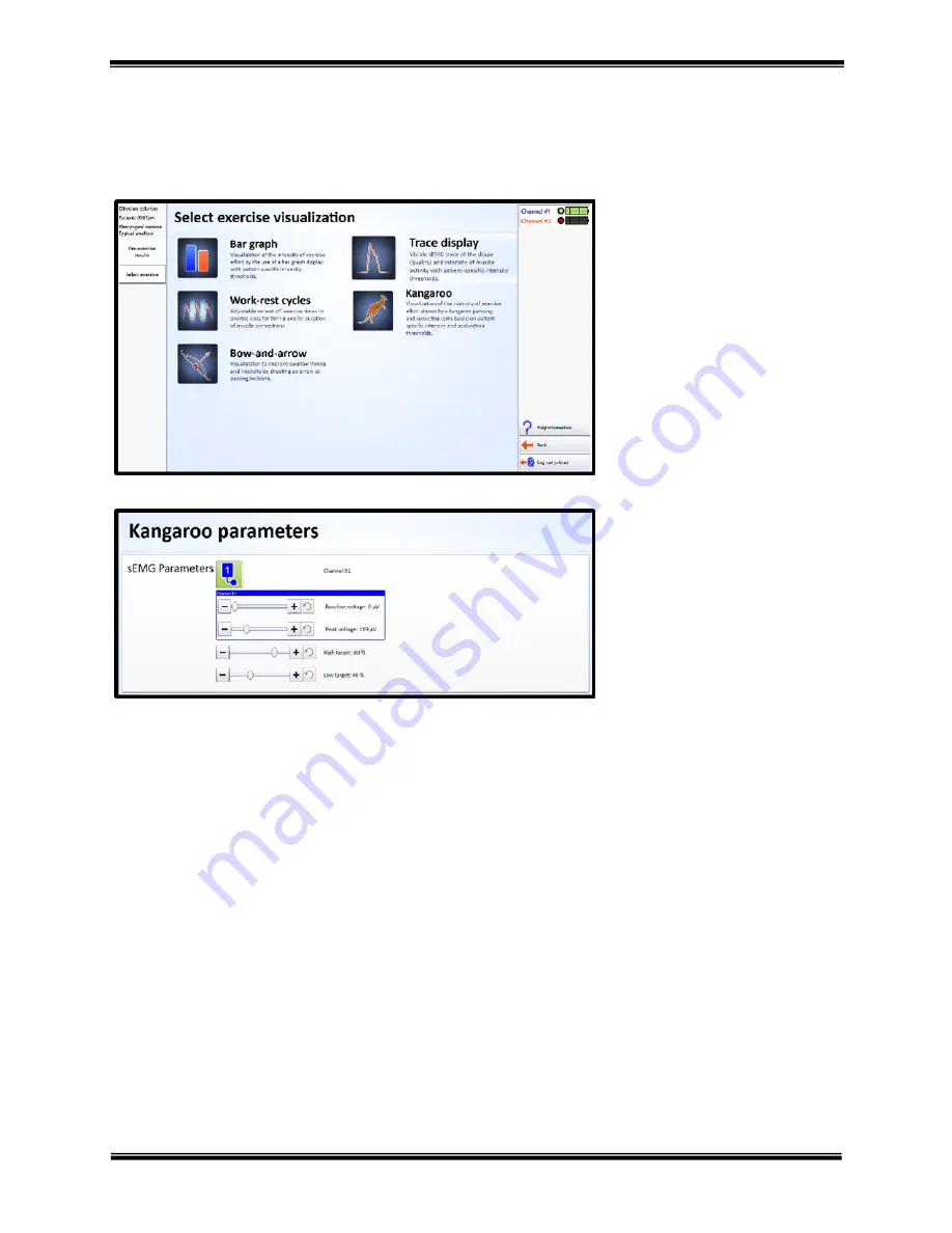 Hanger ACP Synchrony User Manual Download Page 17