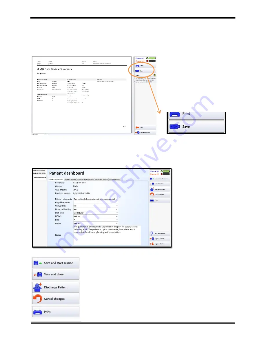 Hanger ACP Synchrony User Manual Download Page 20