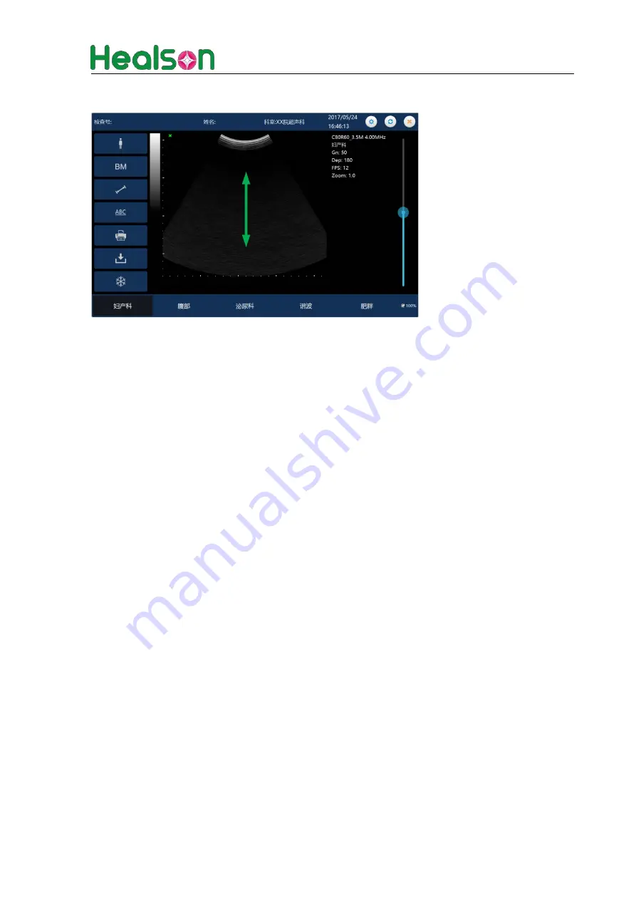 Healson U20 Series User Manual Download Page 71