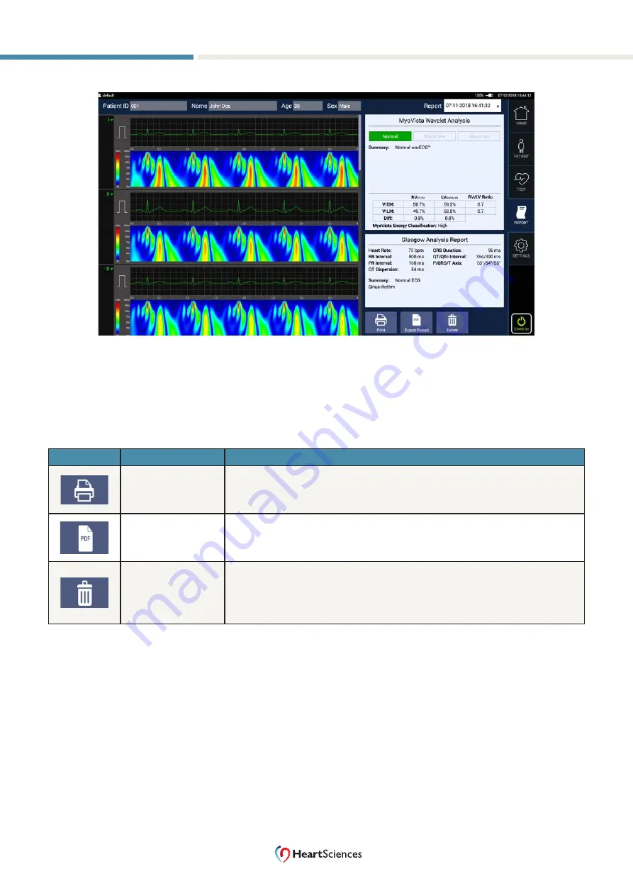 HeartSciences MyoVista  wavECG Скачать руководство пользователя страница 66