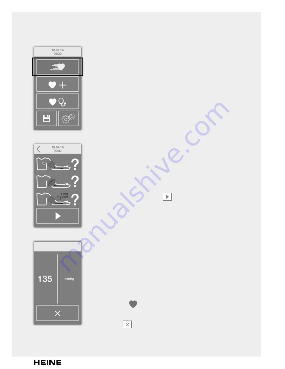 HEINE EN200 BP Instructions For Use Manual Download Page 83