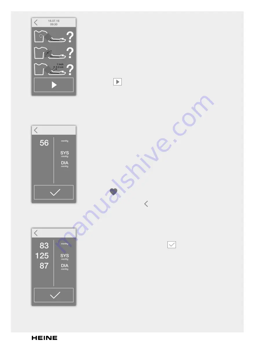 HEINE EN200 BP Instructions For Use Manual Download Page 155