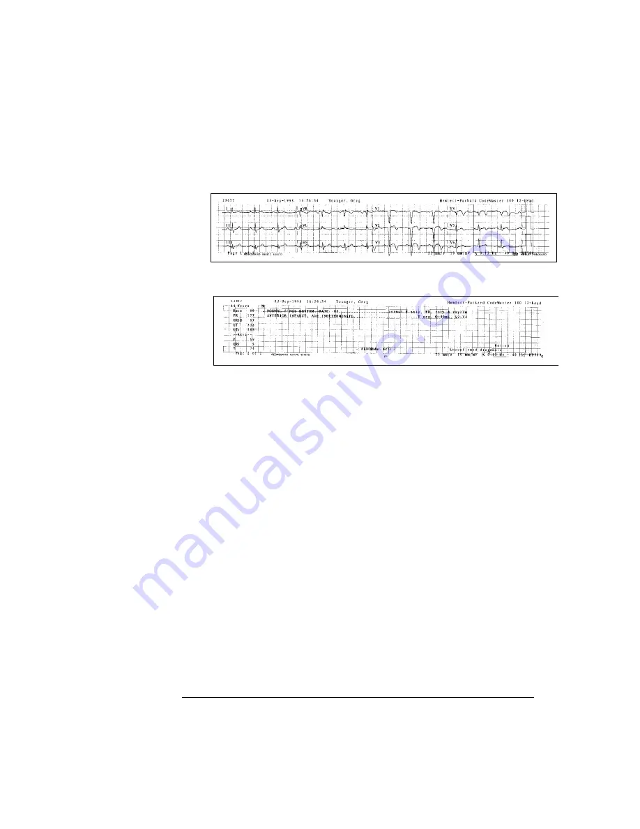 HP Codemaster 100 User Manual Download Page 154