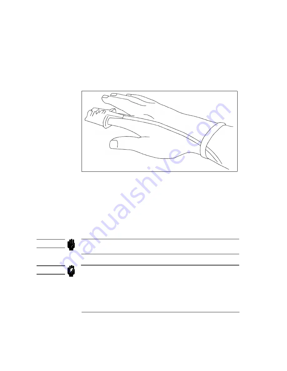 HP CodeMaster XL+ M1722A User Manual Download Page 100