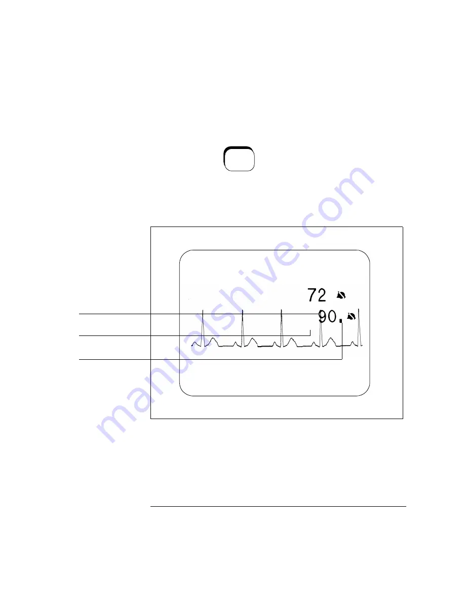 HP CodeMaster XL+ M1722A User Manual Download Page 103