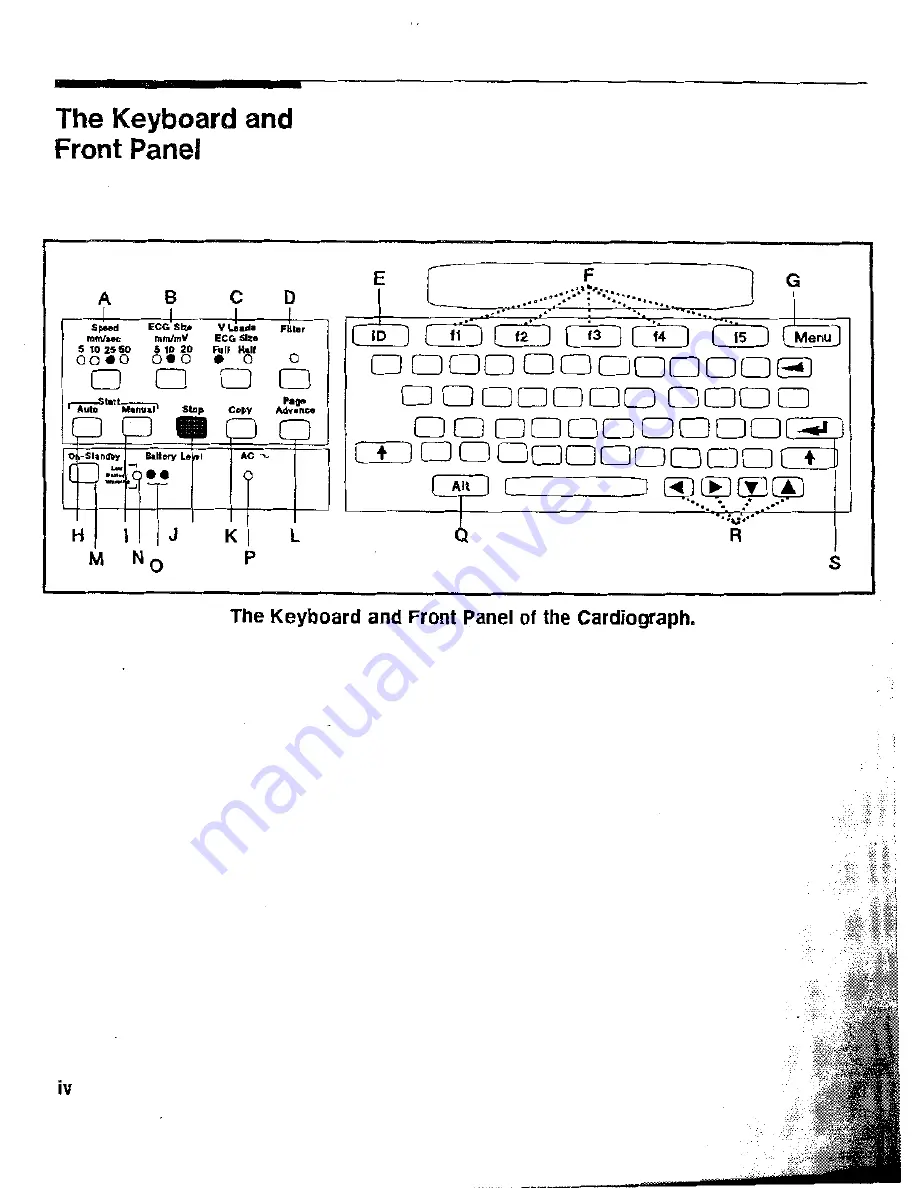 HP Pagewriter XLi M1700A Operating Manual Download Page 2