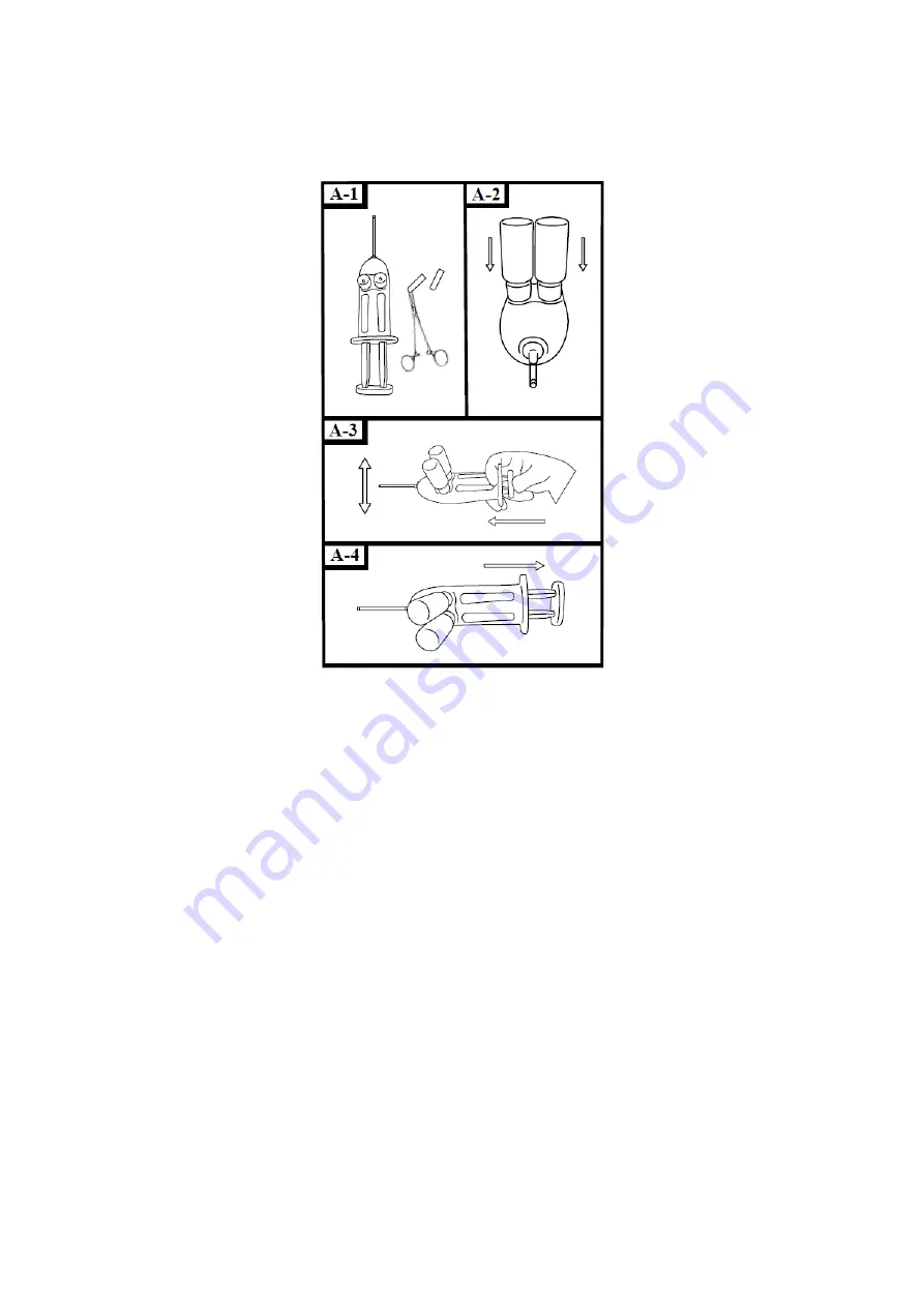 HyperBranch Adherus AutoSpray ET Dural Sealant Instructions For Use Manual Download Page 10