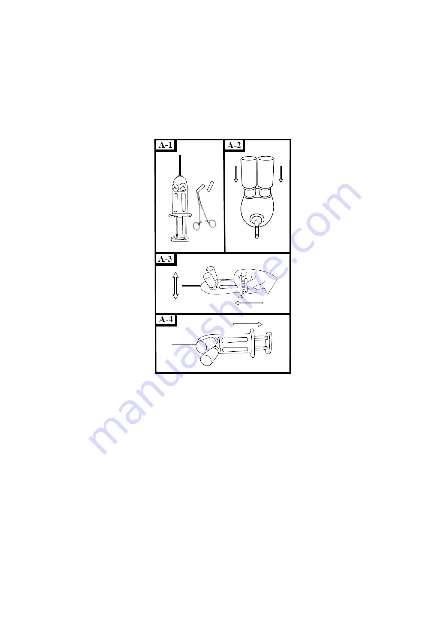 HyperBranch Adherus AutoSpray ET Dural Sealant Instructions For Use Manual Download Page 25