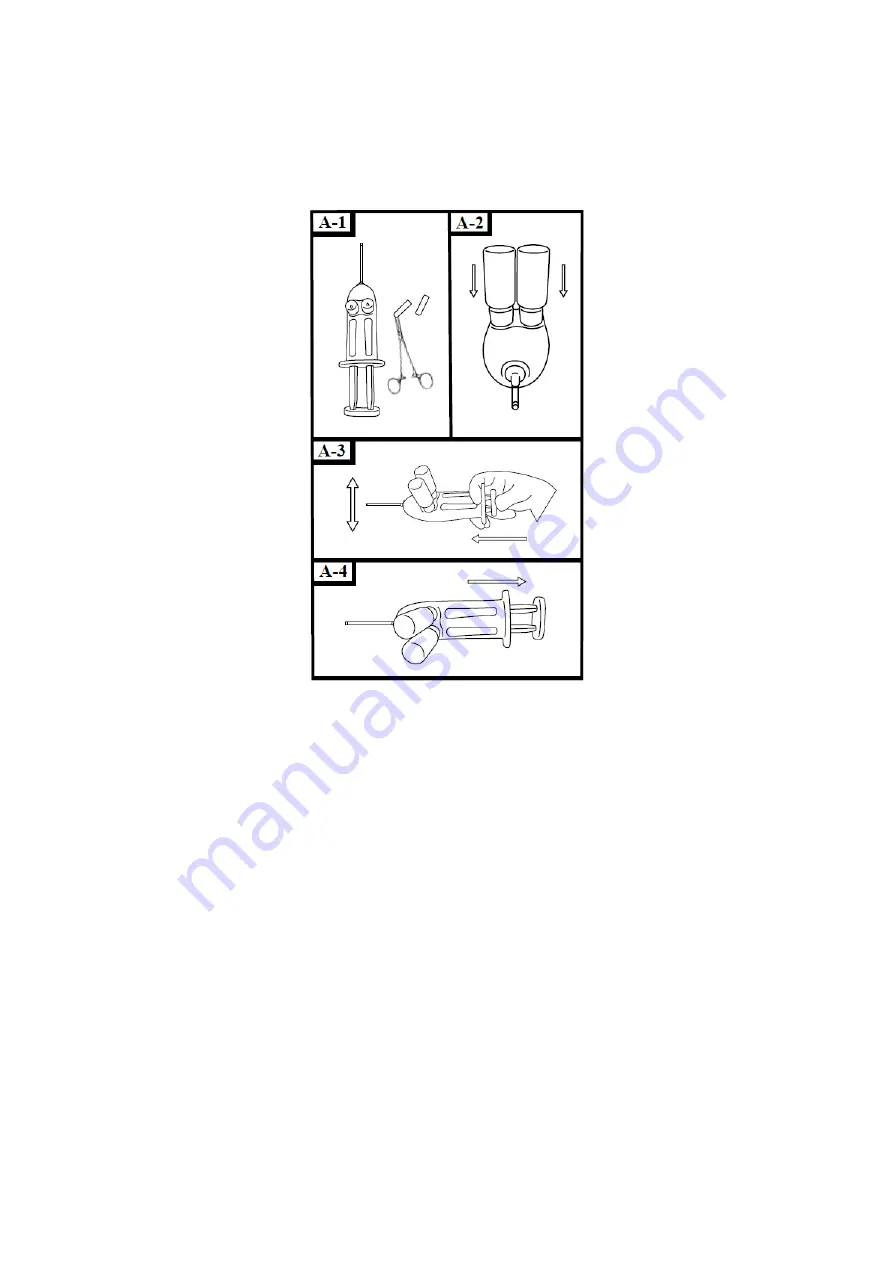 HyperBranch Adherus AutoSpray ET Dural Sealant Instructions For Use Manual Download Page 133