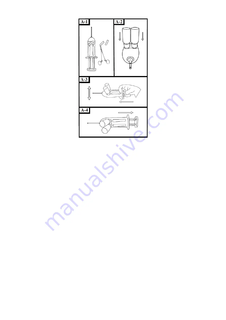 HyperBranch Adherus AutoSpray ET Dural Sealant Instructions For Use Manual Download Page 176