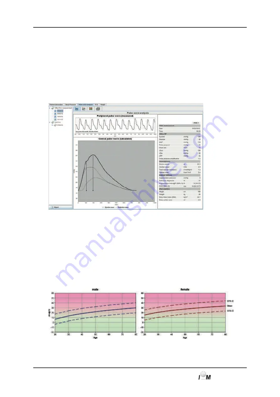 IEM Mobil-O-Graph NG Operating Instructions Manual Download Page 65