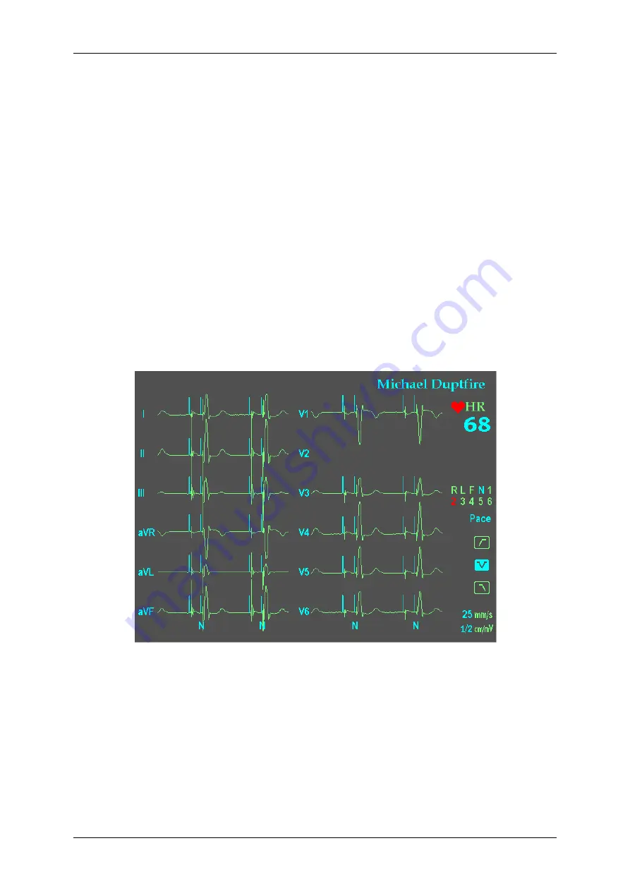 Innomed Medical HeartScreen112 Clinic Скачать руководство пользователя страница 20