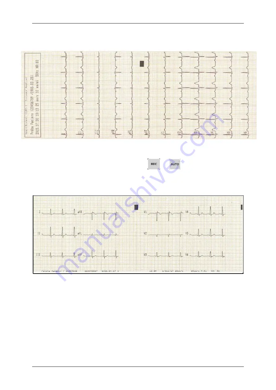 Innomed Medical HeartScreen112 Clinic Скачать руководство пользователя страница 29