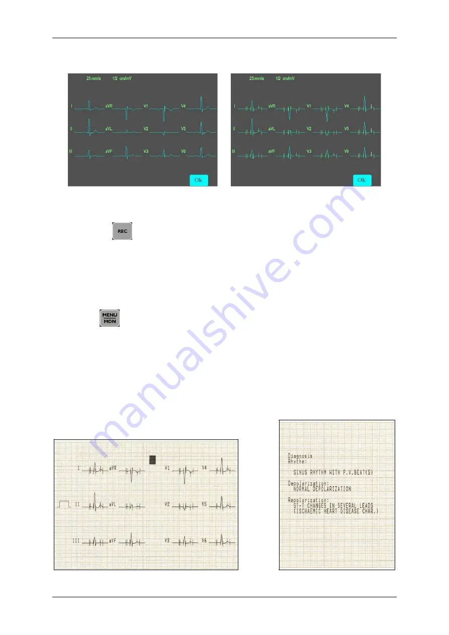 Innomed Medical HeartScreen112 Clinic User Manual Download Page 48