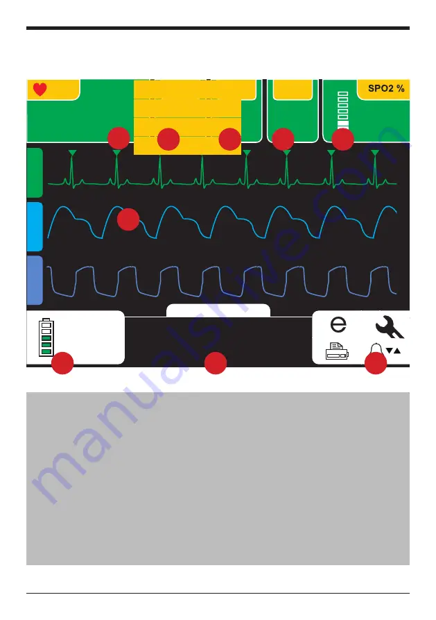 Instramed CardioMax User Manual Download Page 43