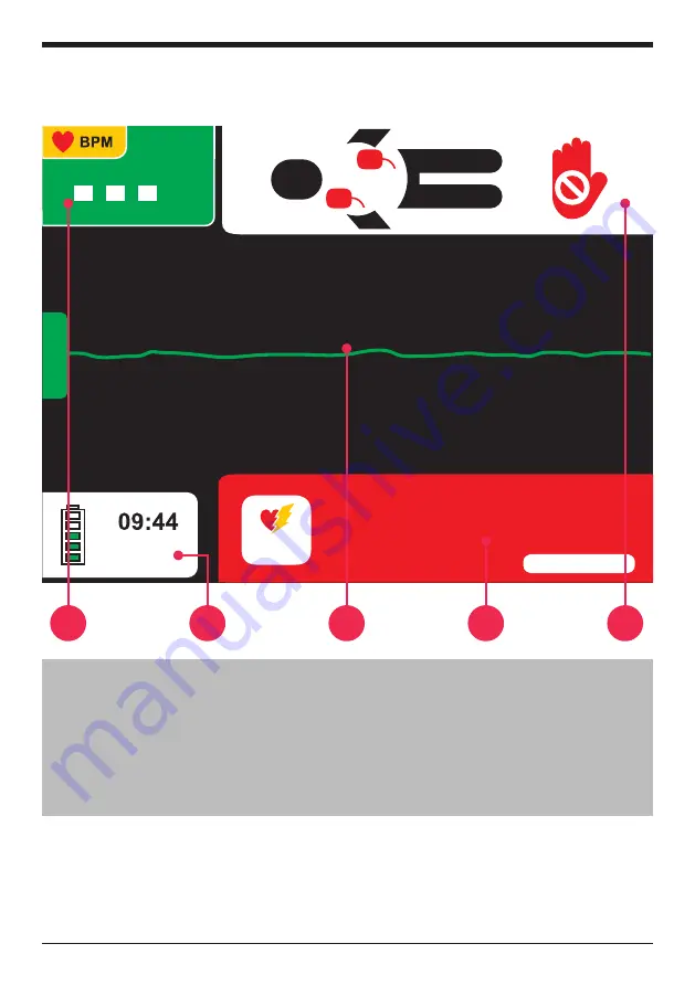 Instramed CardioMax User Manual Download Page 45