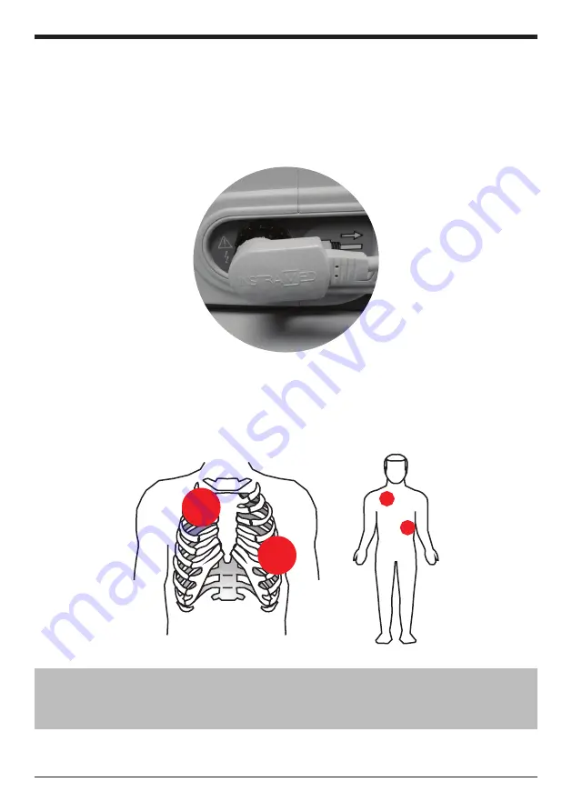 Instramed CardioMax Скачать руководство пользователя страница 71