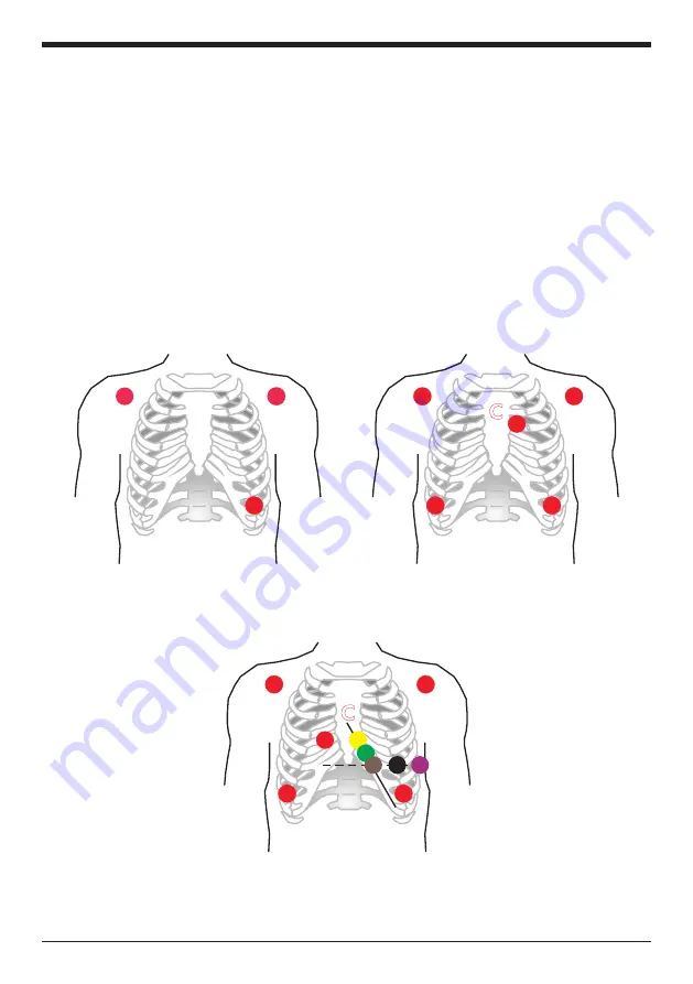 Instramed CardioMax Скачать руководство пользователя страница 102