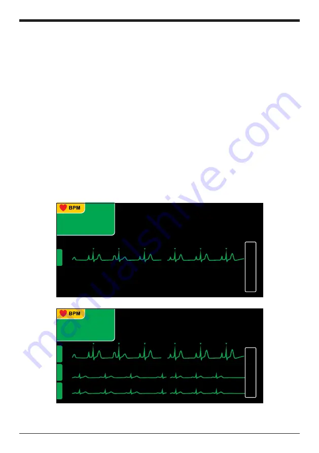 Instramed CardioMax Скачать руководство пользователя страница 107