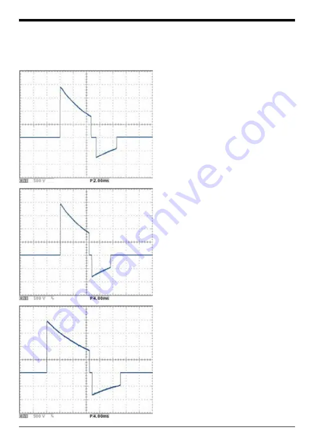 Instramed EazyPro User Manual Download Page 65