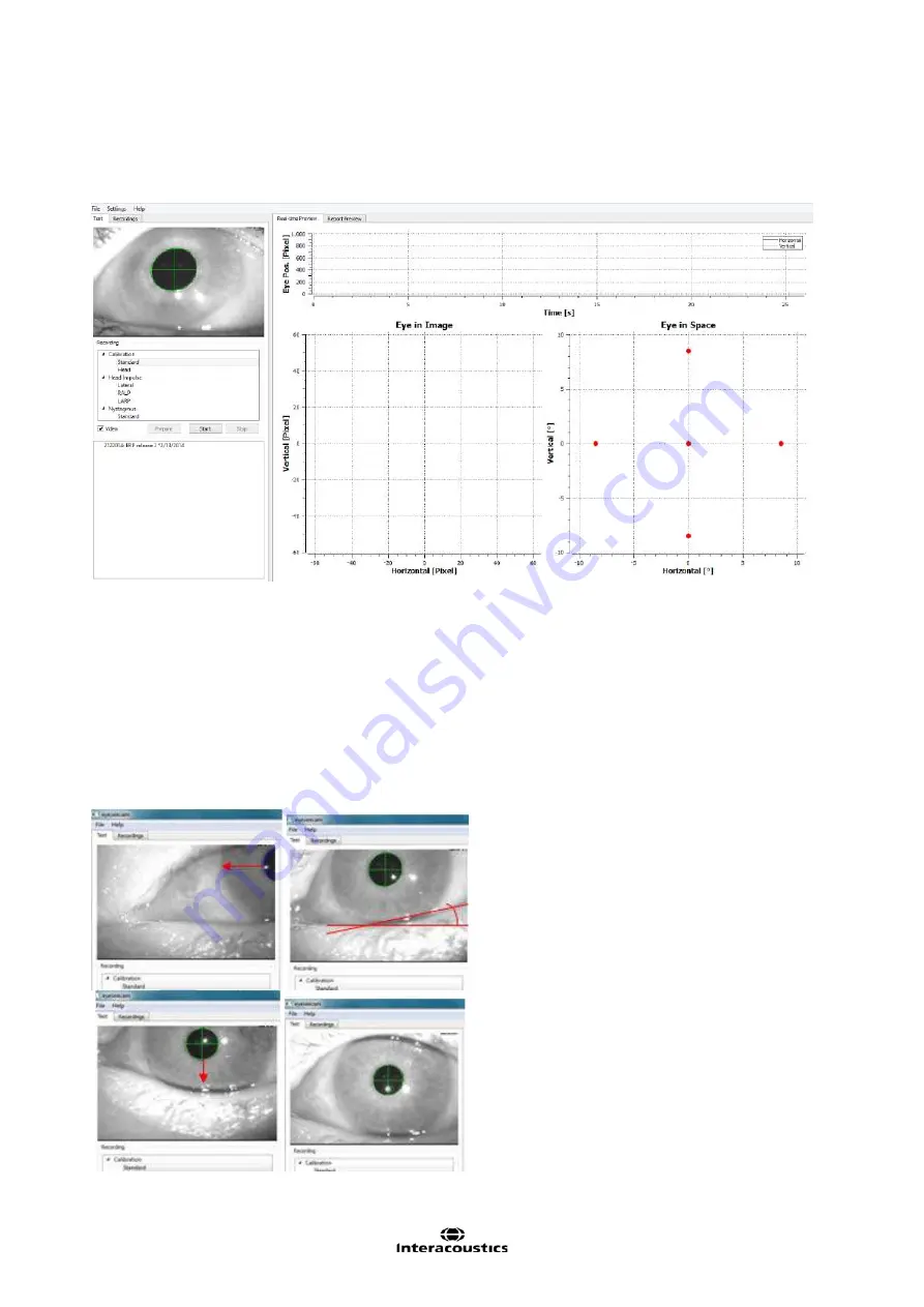 Interacoustics EyeSeeCam Instructions For Use Manual Download Page 25