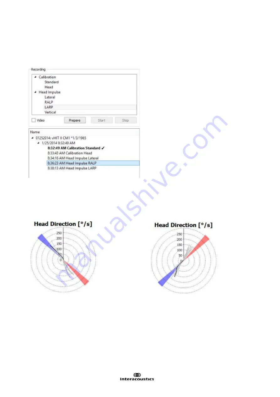 Interacoustics EyeSeeCam Скачать руководство пользователя страница 86