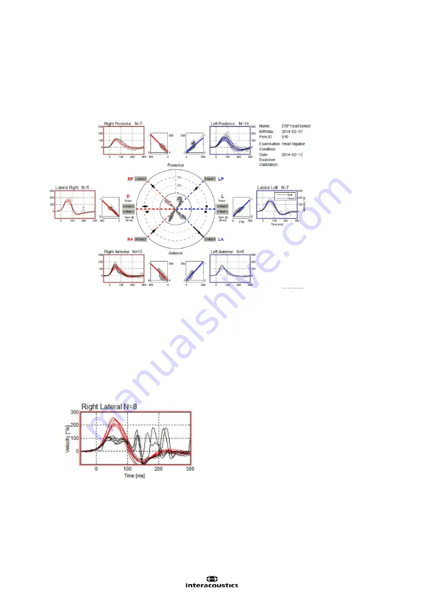 Interacoustics EyeSeeCam Instructions For Use Manual Download Page 89