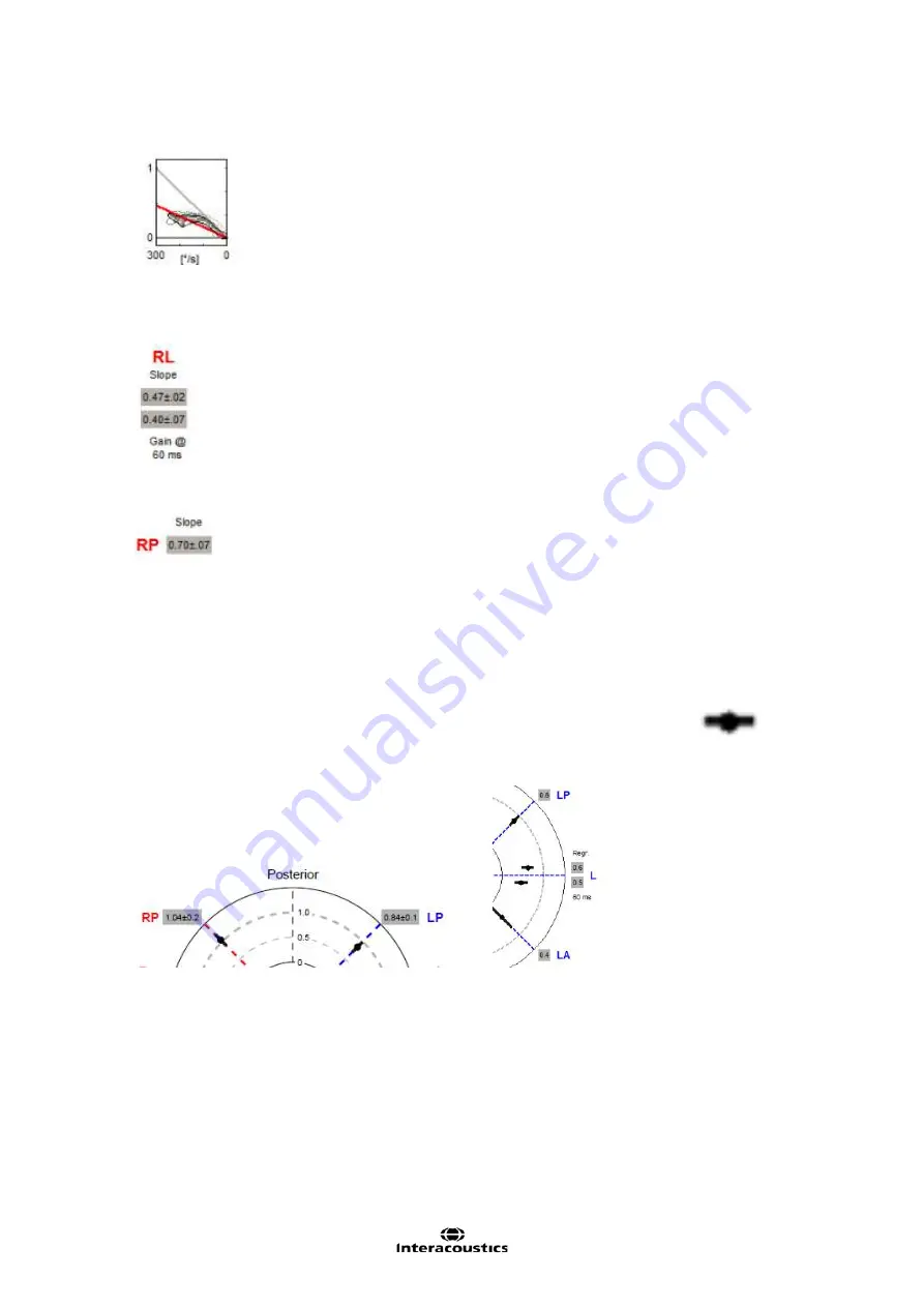 Interacoustics EyeSeeCam Instructions For Use Manual Download Page 90