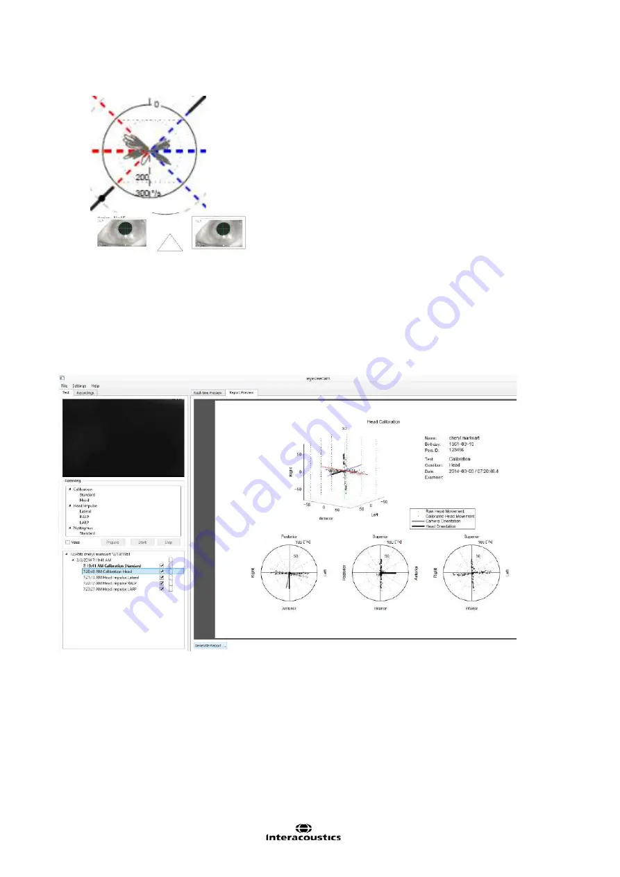 Interacoustics EyeSeeCam Instructions For Use Manual Download Page 91