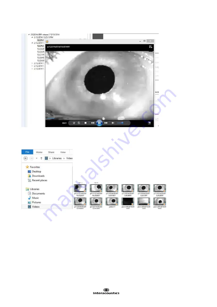 Interacoustics EyeSeeCam Instructions For Use Manual Download Page 96