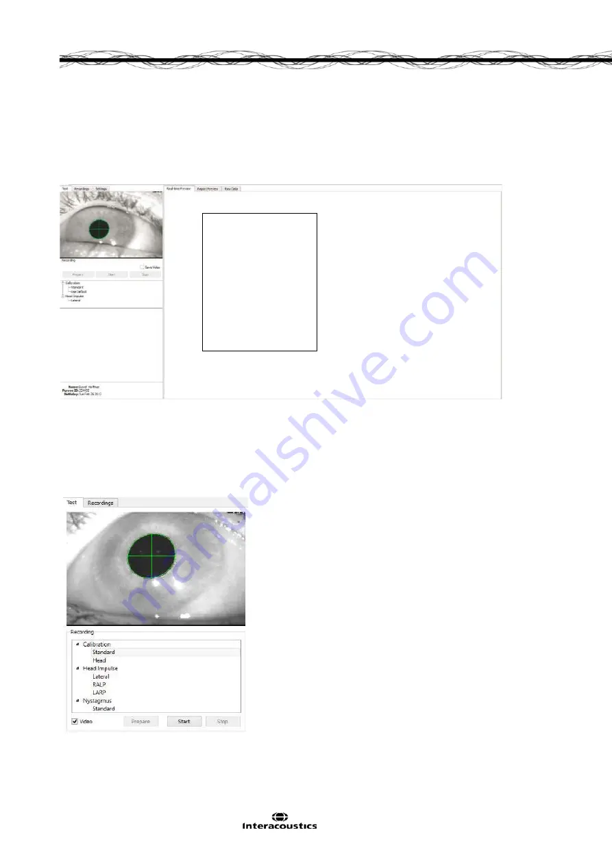 Interacoustics EyeSeeCam Instructions For Use Manual Download Page 126